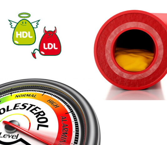 HDL e LDL