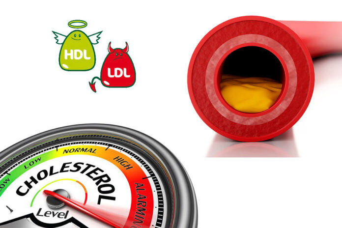 HDL e LDL